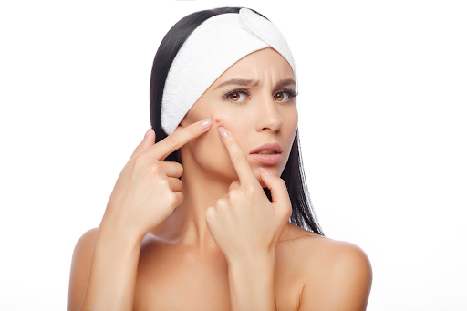 A concerned woman wearing only a headband uses fingers on both hands to poke a zit on her face.